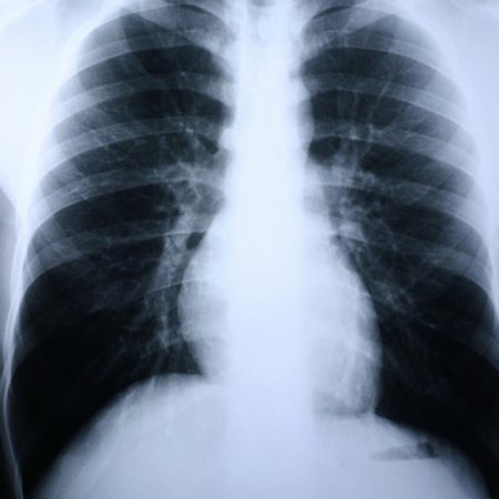 381332_pdet 381332_pdet