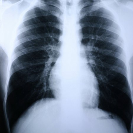 386068_pdet 386068_pdet