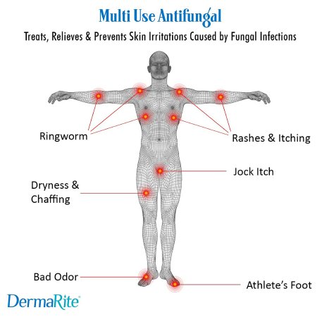 584144_mktg3 584144_mktg3